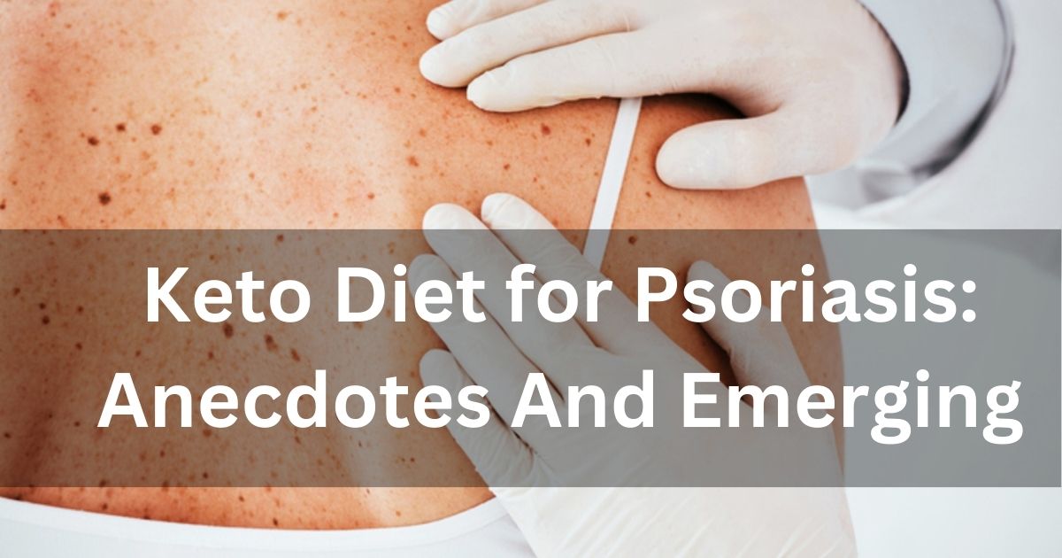 Keto Diet for Psoriasis: Soothe Your Skin Naturally