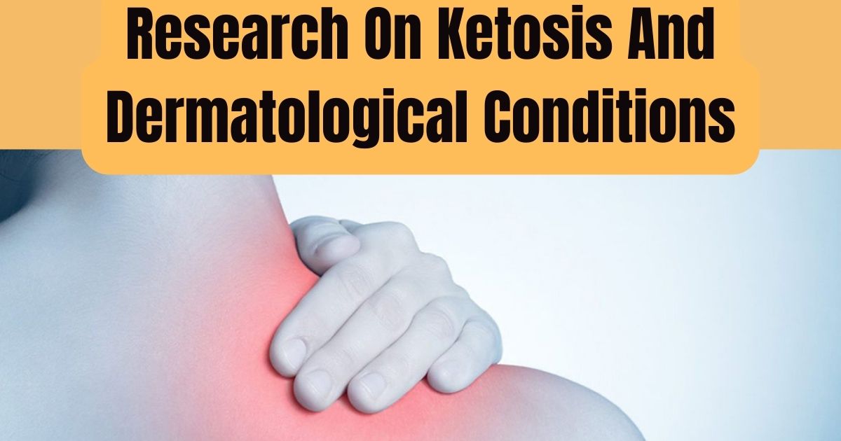 Keto Diet for Rosacea: Clear Skin Breakthrough 2024 3 Keto Diet for Rosacea: Clear Skin Breakthrough 2024